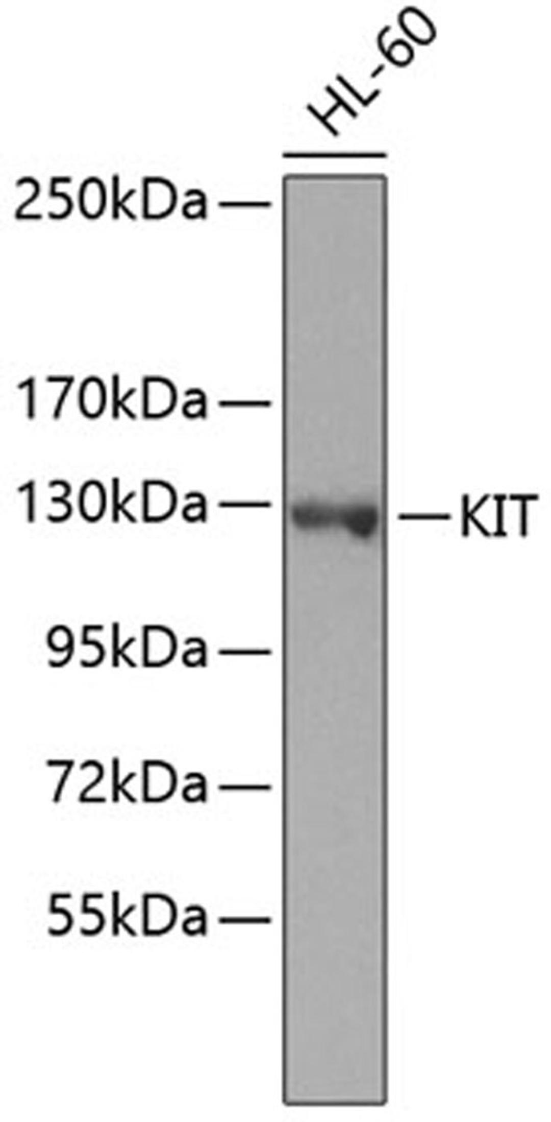 Western blot - KIT antibody (A7521)