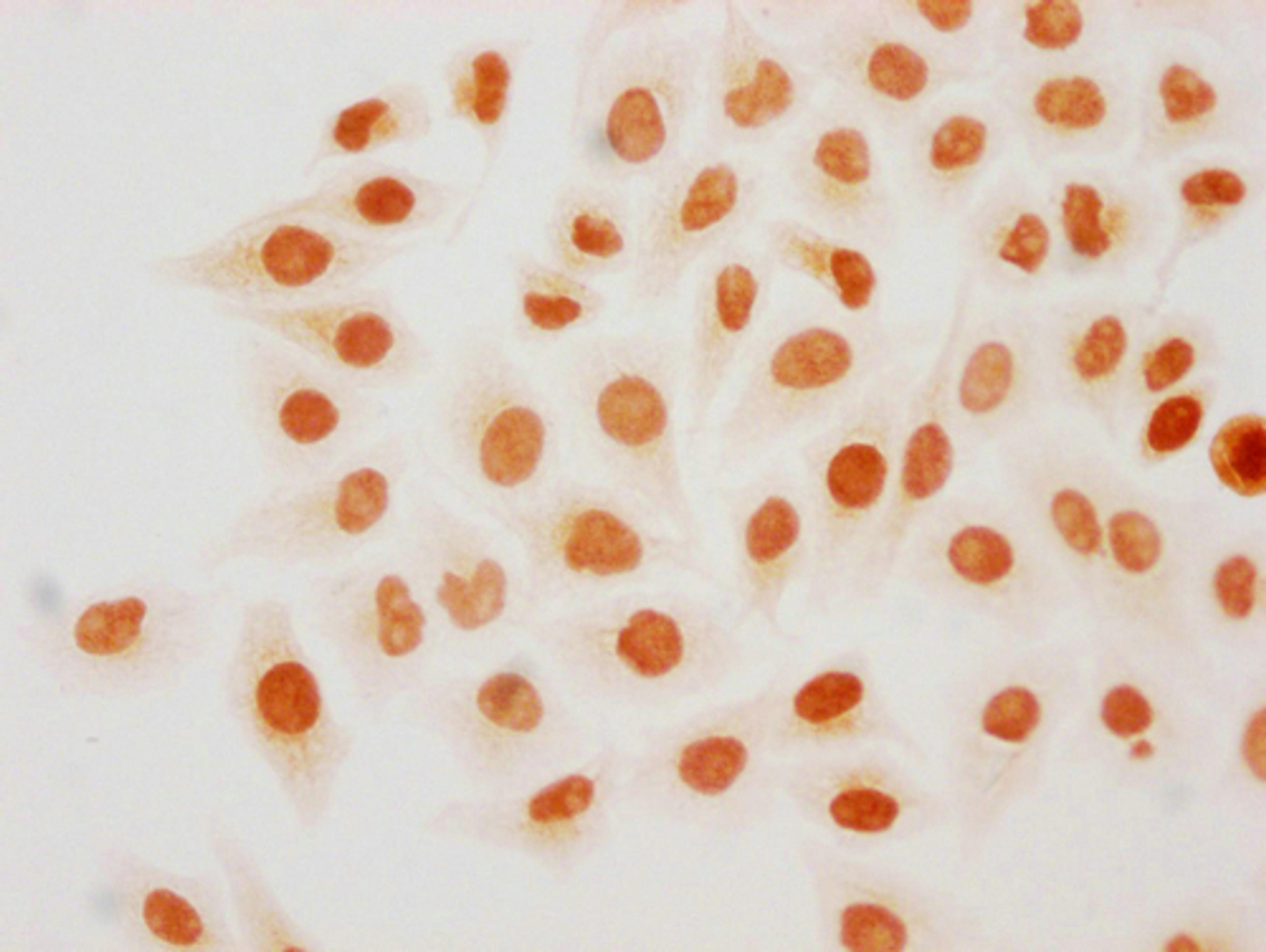 Immunocytochemistry analysis of CSB-PA010418PA18forHU diluted at 1:20 and staining in Hela cells(treated with 30mM sodium butyrate for 4h) performed on a Leica BondTM system. The cells were fixed in 4% formaldehyde, permeabilized using 0.2% Triton X-100 and blocked with 10% normal goat serum 30min at RT. Then primary antibody (1% BSA) was incubated at 4°C overnight. The primary is detected by a biotinylated secondary antibody and visualized using an HRP conjugated SP system.