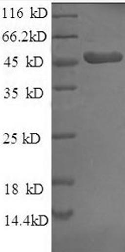 (Tris-Glycine gel) Discontinuous SDS-PAGE (reduced) with 5% enrichment gel and 15% separation gel.