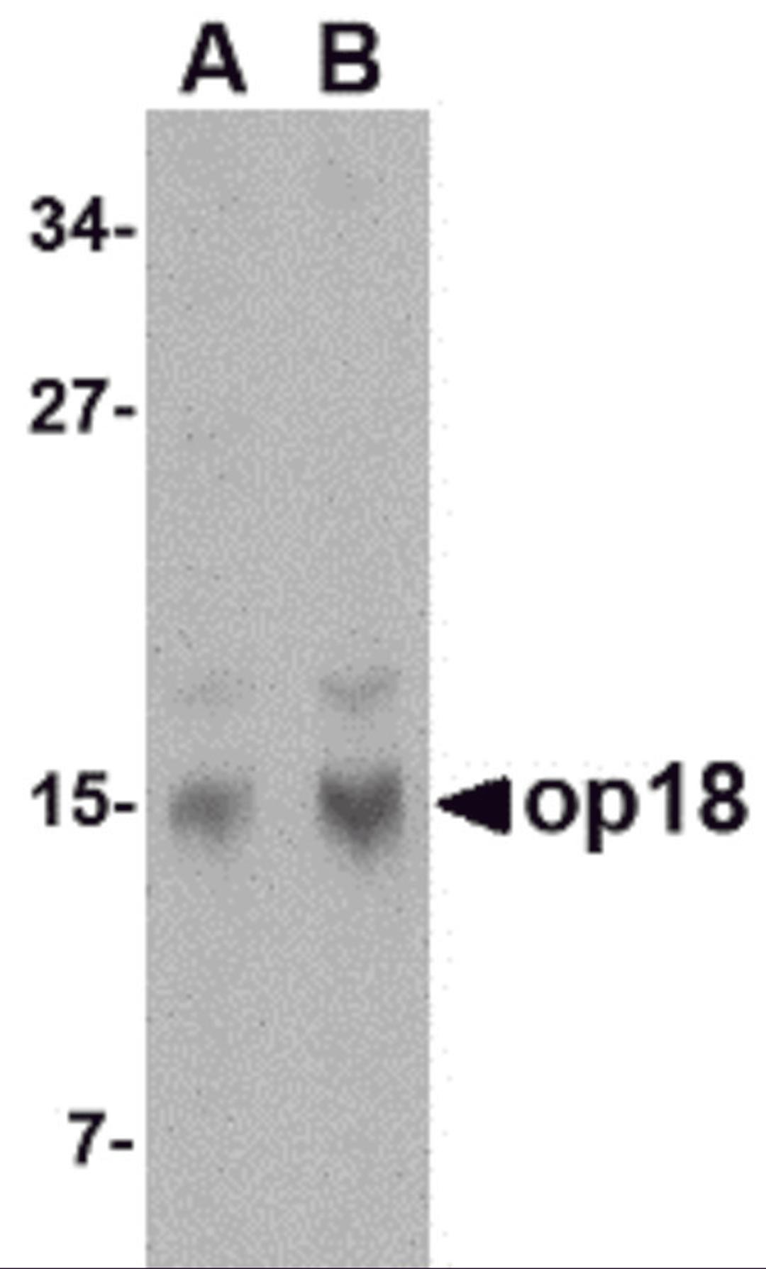 Western blot analysis of op18 in human brain tissue lysate with op18 antibody at (A) 0.5 and (B) 1 &#956;g/mL.