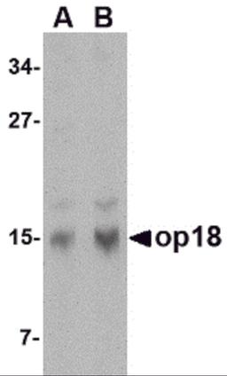 Western blot analysis of op18 in human brain tissue lysate with op18 antibody at (A) 0.5 and (B) 1 μg/mL.