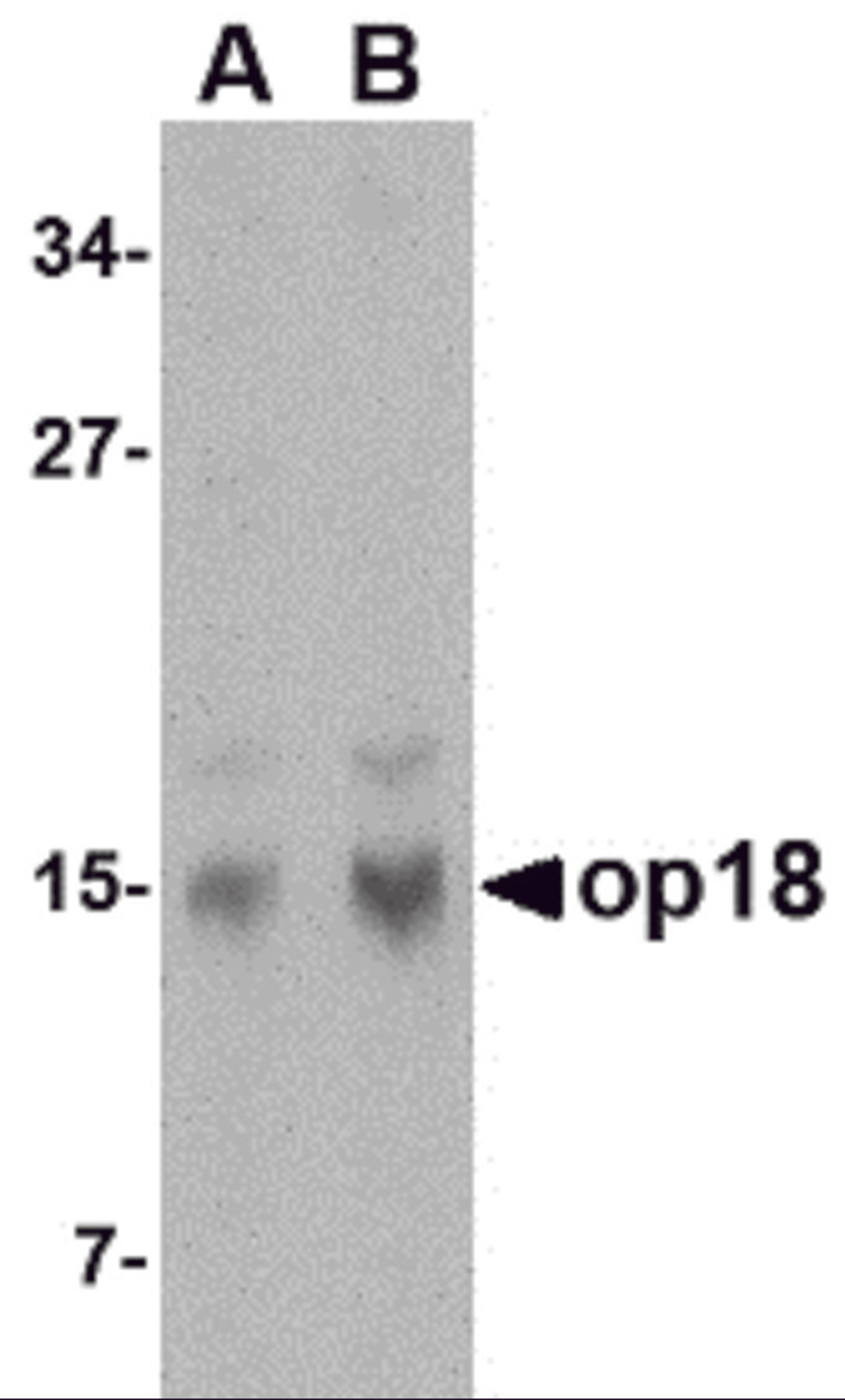 Western blot analysis of op18 in human brain tissue lysate with op18 antibody at (A) 0.5 and (B) 1 μg/mL.