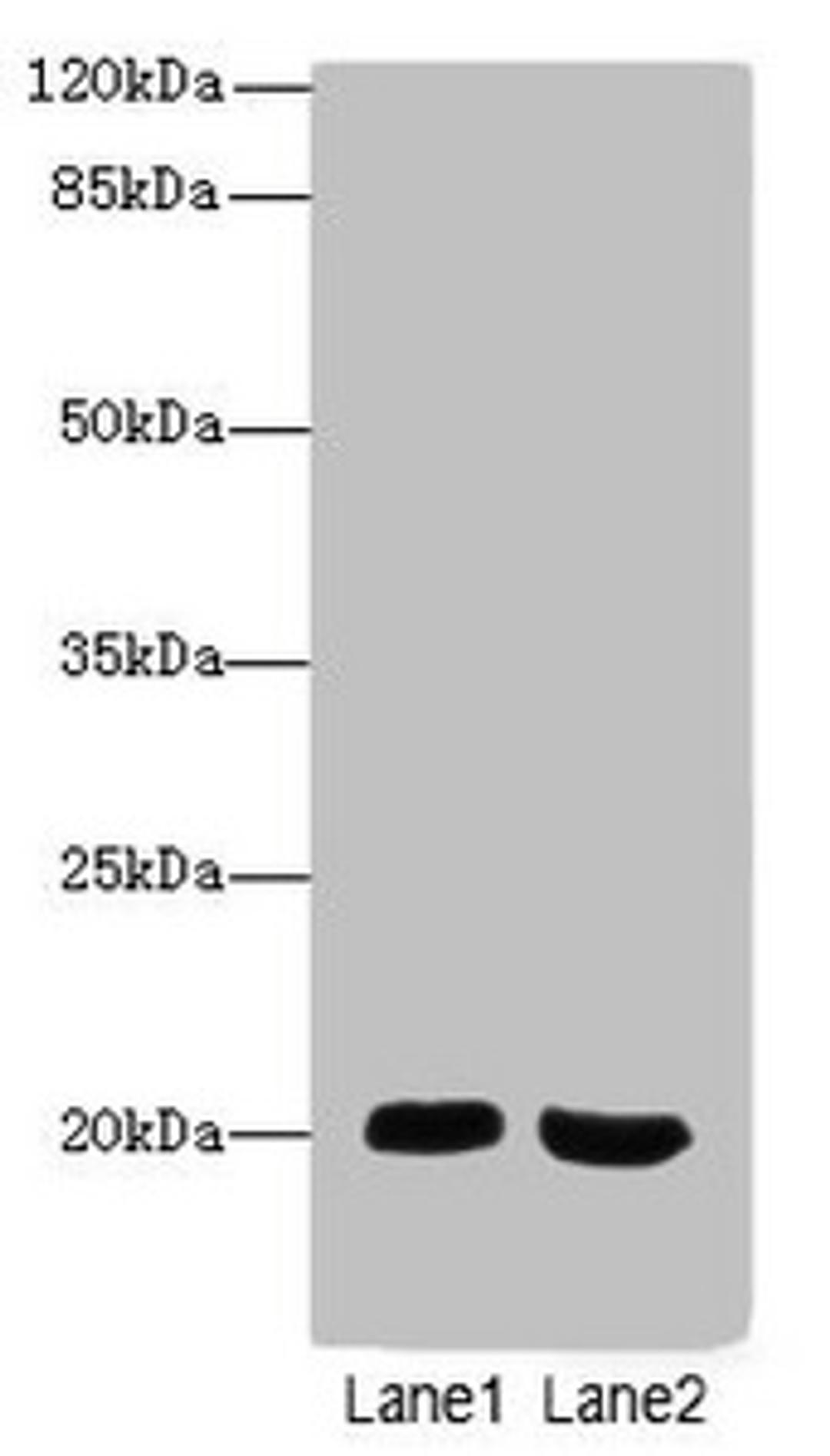 Western blot. All lanes: MSRB2antibody at 2.66ug/ml. Lane 1: Mouse heart tissue. Lane 2: Mouse brain tissue. Secondary. Goat polyclonal to rabbit IgG at 1/10000 dilution. Predicted band size: 20 kDa. Observed band size: 20 kDa.
