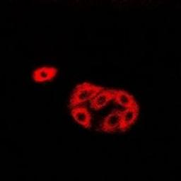 Immunofluorescent analysis of Hela cells using HAPLN1 antibody