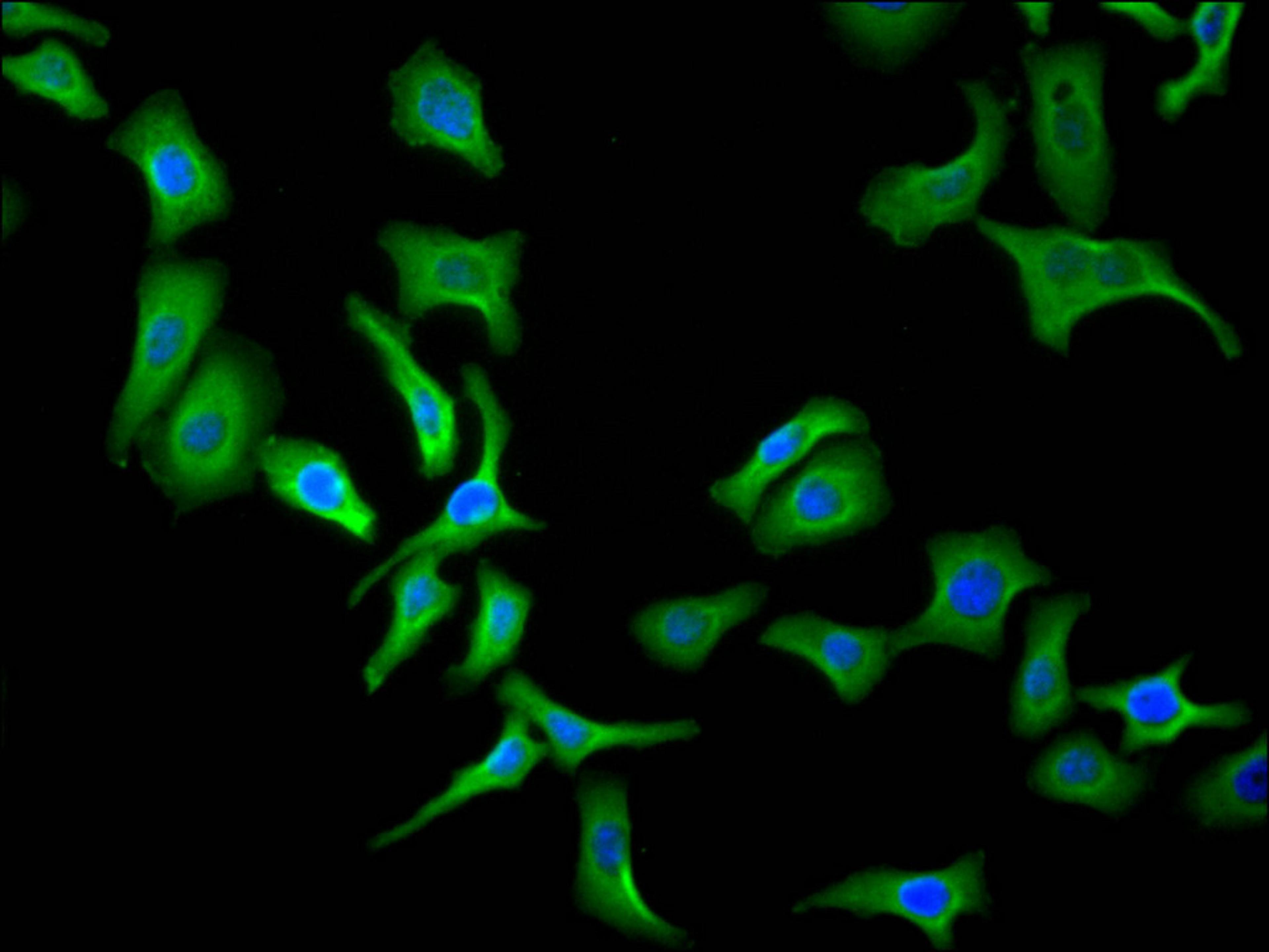 Immunofluorescence staining of Hela cell with CSB-RA001950MA3HU at 1:30, counter-stained with DAPI. The cells were fixed in 4% formaldehyde and blocked in 10% normal Goat Serum. The cells were then incubated with the antibody overnight at 4C. The secondary antibody was FITC-conjugated AffiniPure Goat Anti-Human IgG(H+L).