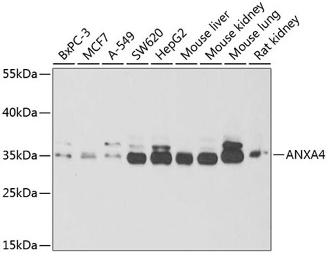 Western blot - ANXA4 antibody (A6280)