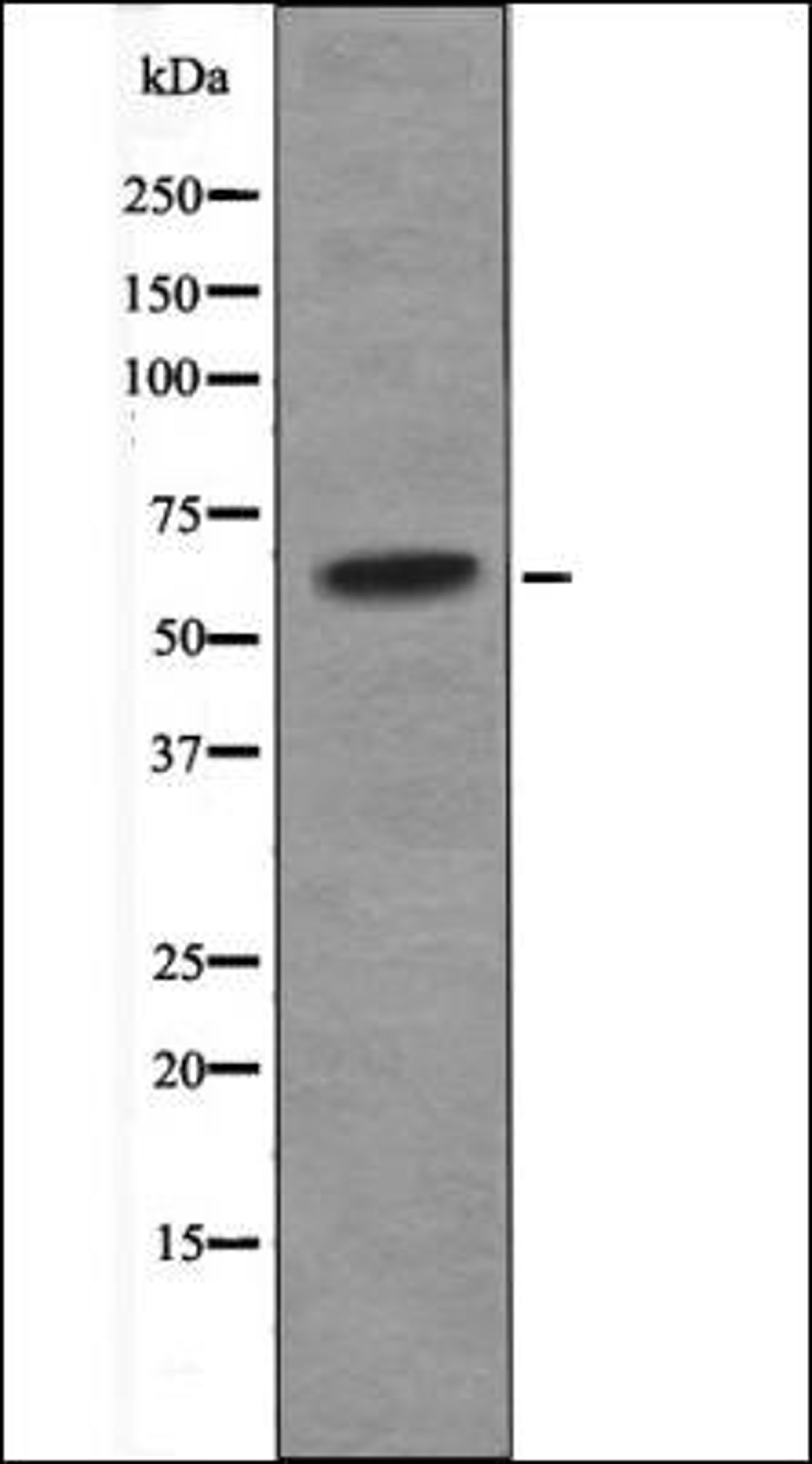 Western blot analysis of Jurkat whole cell lysates using CHK2 -Phospho-Ser33+Ser35- antibody