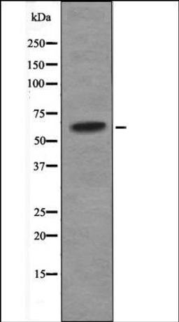 Western blot analysis of Jurkat whole cell lysates using CHK2 -Phospho-Ser33+Ser35- antibody