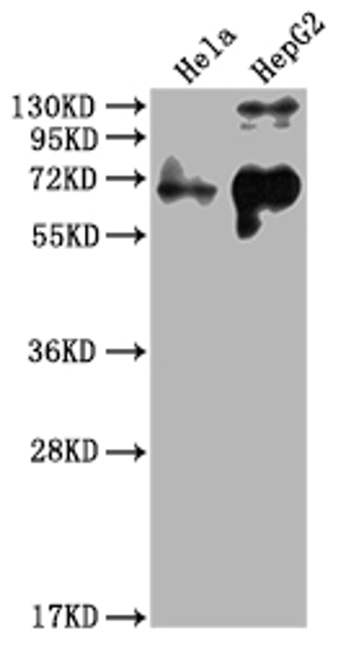 Western Blot. Positive WB detected in: Hela whole cell lysate, HepG2 whole cell lysate. All lanes: YAP1 antibody at 1:2000. Secondary. Goat polyclonal to rabbit IgG at 1/50000 dilution. Predicted band size: 55, 53, 49, 37, 49, 50, 51, 54 kDa. Observed band size: 65 kDa.