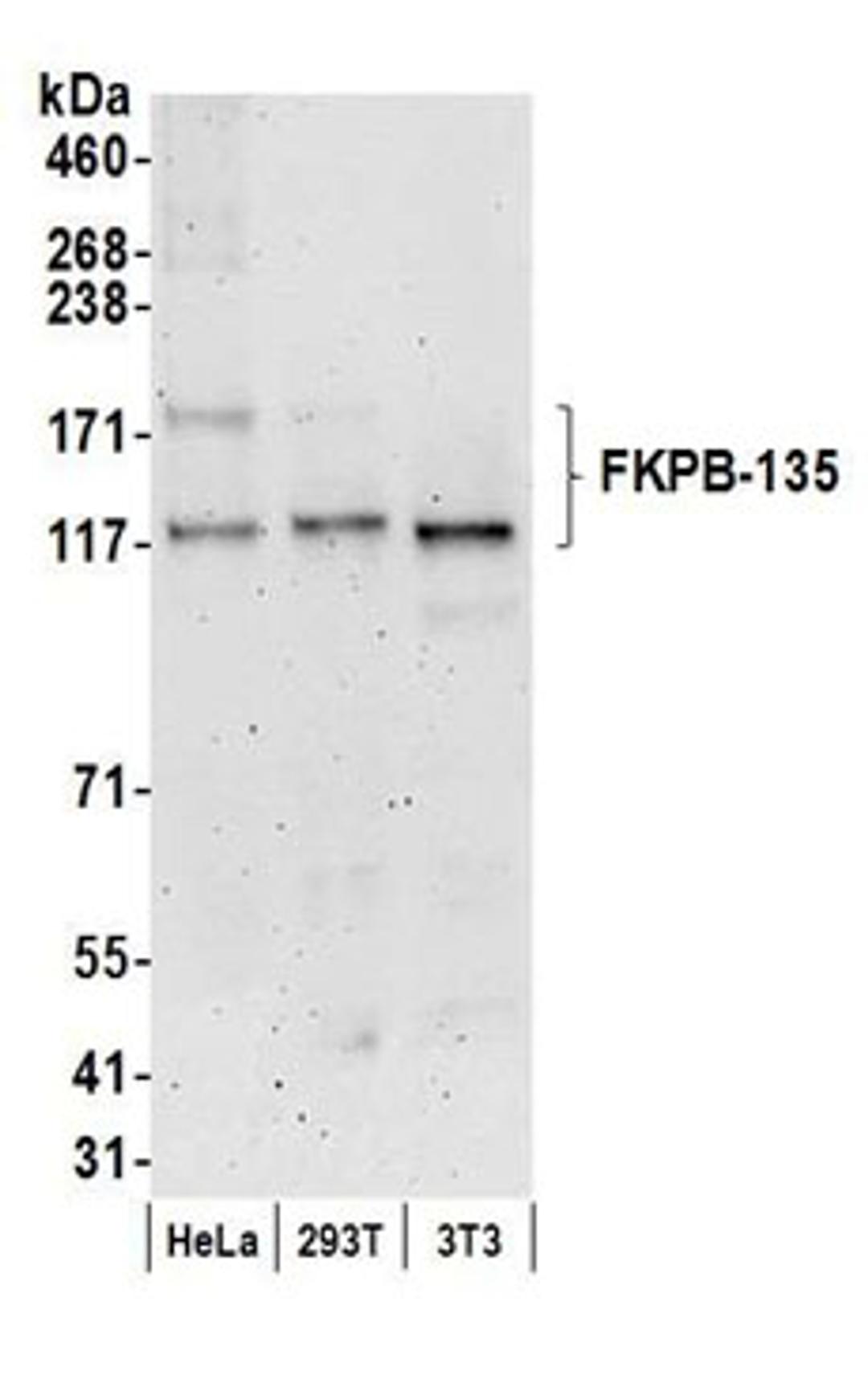 Detection of human and mouse FKPB-135 by western blot.