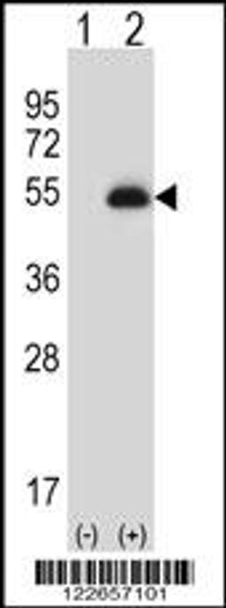 Western blot analysis of PAX6 using rabbit polyclonal PAX6 Antibody using 293 cell lysates (2 ug/lane) either nontransfected (Lane 1) or transiently transfected (Lane 2) with the PAX6 gene.