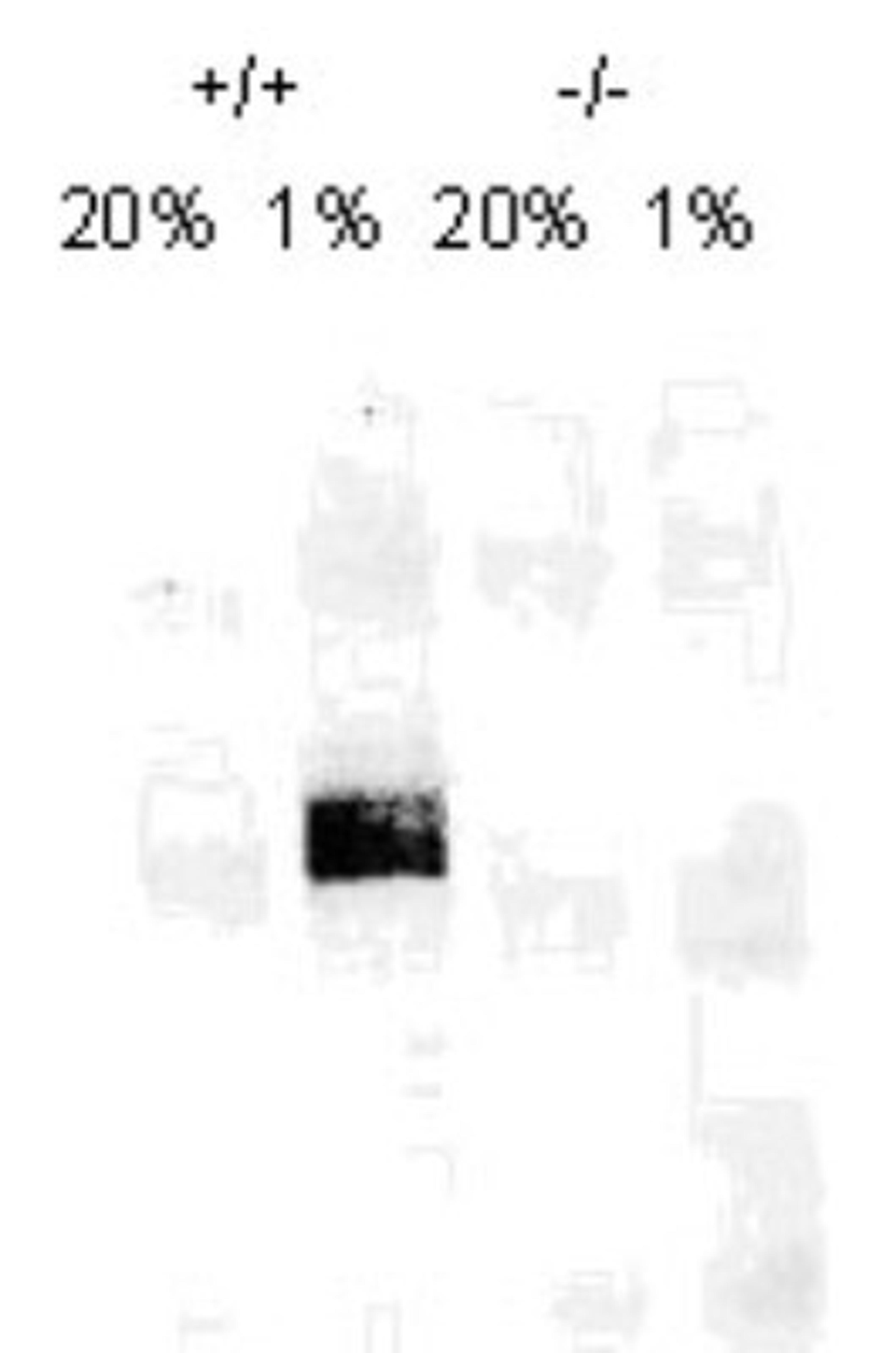 Western Blot: HIF-1 alpha Antibody (H1alpha67) [NB100-123] - Analysis using the HRP conjugate of NB100-123. On day 1, MEF cells (+/+,-/-), were grown on 15cm dish (2x10 to the 6th cells). On day 2, cells were exposed to hypoxia for 4hrs. Cells were washed with ice cold PBS twice and whole cell protein was extracted extracted with RIPA buffer fortified with protease. Upon quantification, 100ug of protein was fractionated on 7% polyacralymide gel. Gel was transferred overnight onto nitrocellulose membrane. The membrane was probed with HIF-1 alpha monoclonal antibody at a 1:500 dilution (NB100-123). The secondary antibody was conjugated with HRP and was used at a 1:2500 dilution. Photo courtesy of Dr. Gregg Semenza, Johns Hopkins University.