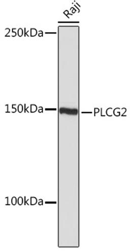 Western blot - PLCG2 Rabbit mAb (A5182)