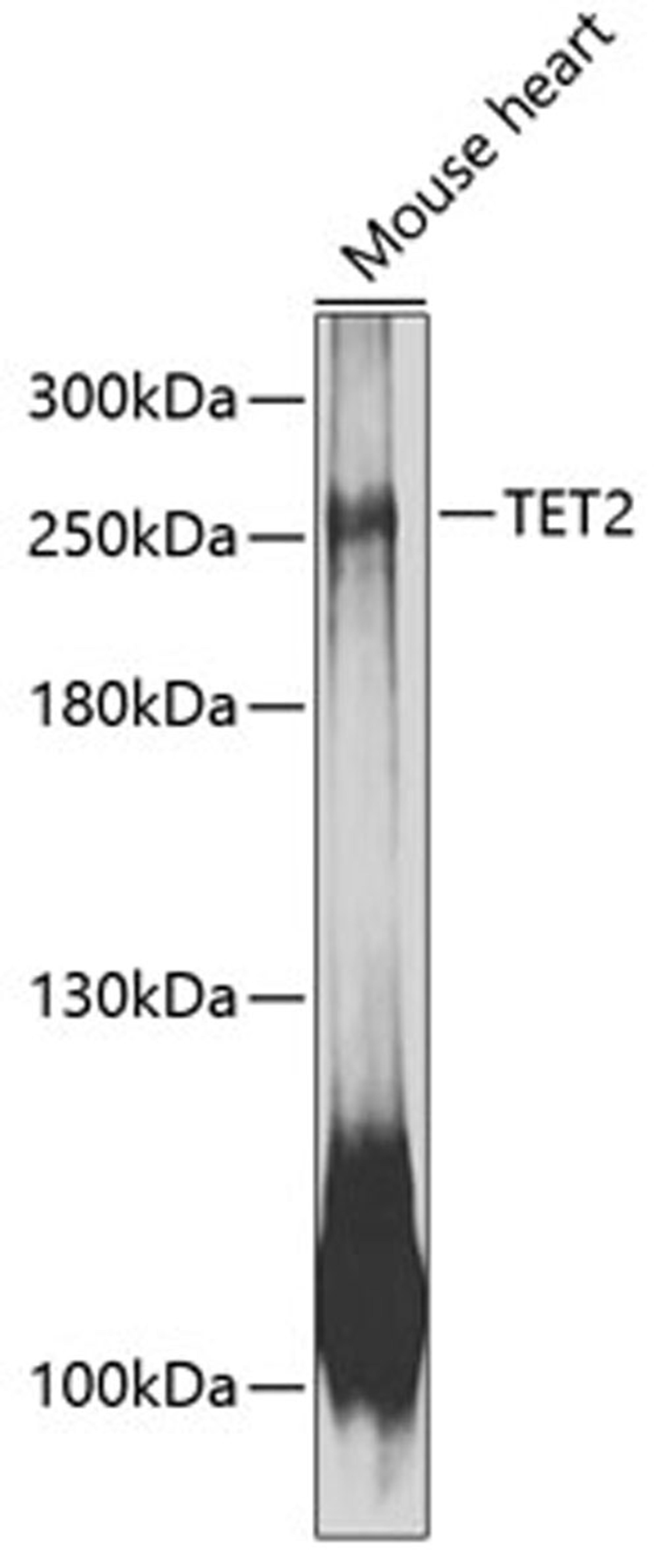 Western blot - TET2 antibody (A12779)