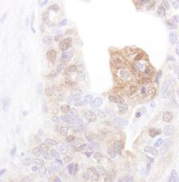 Detection of human CanK4 by immunohistochemistry.