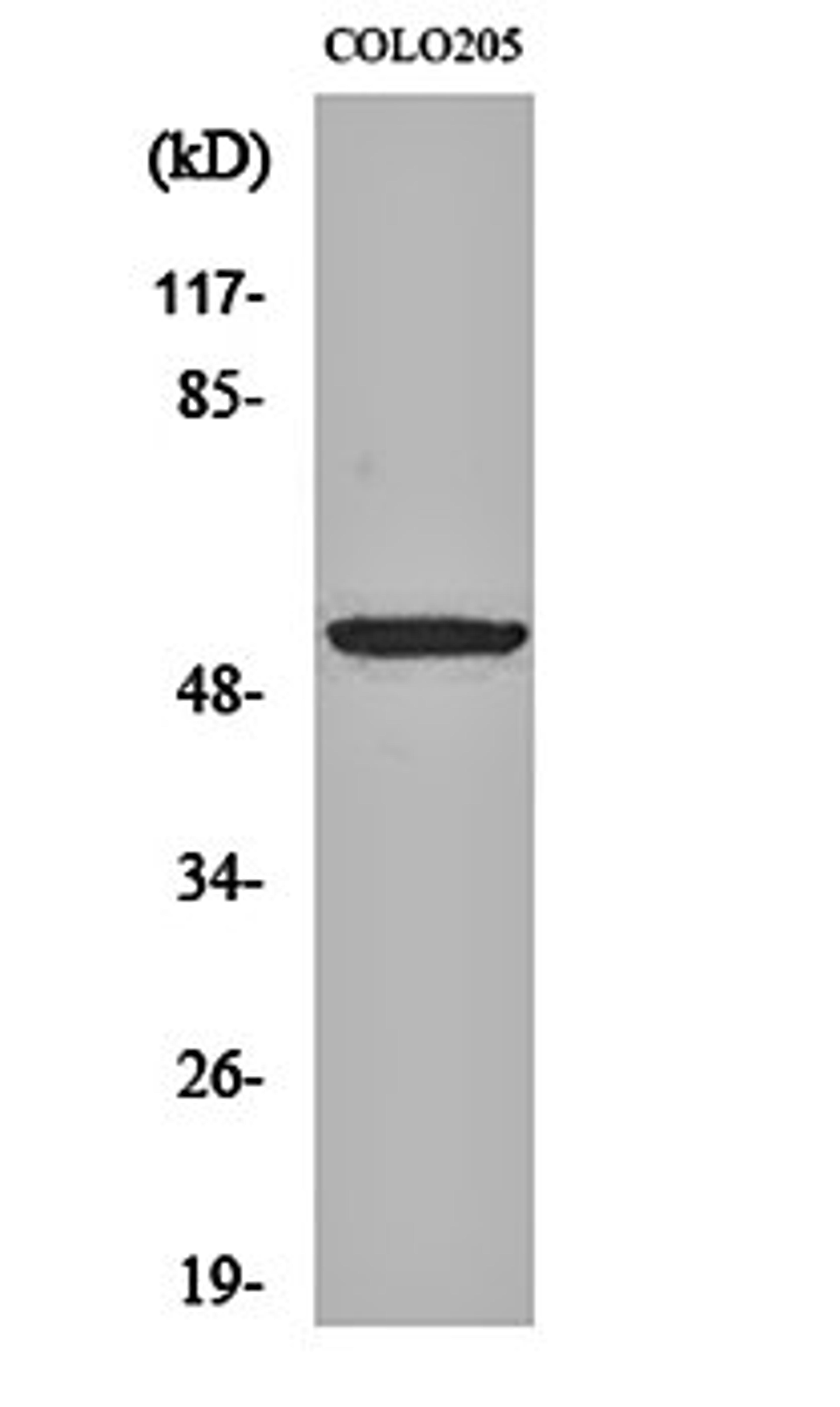 Western blot analysis of COLO205 cell lysates using EP4 antibody