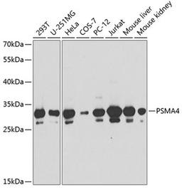 Western blot - PSMA4 antibody (A13535)