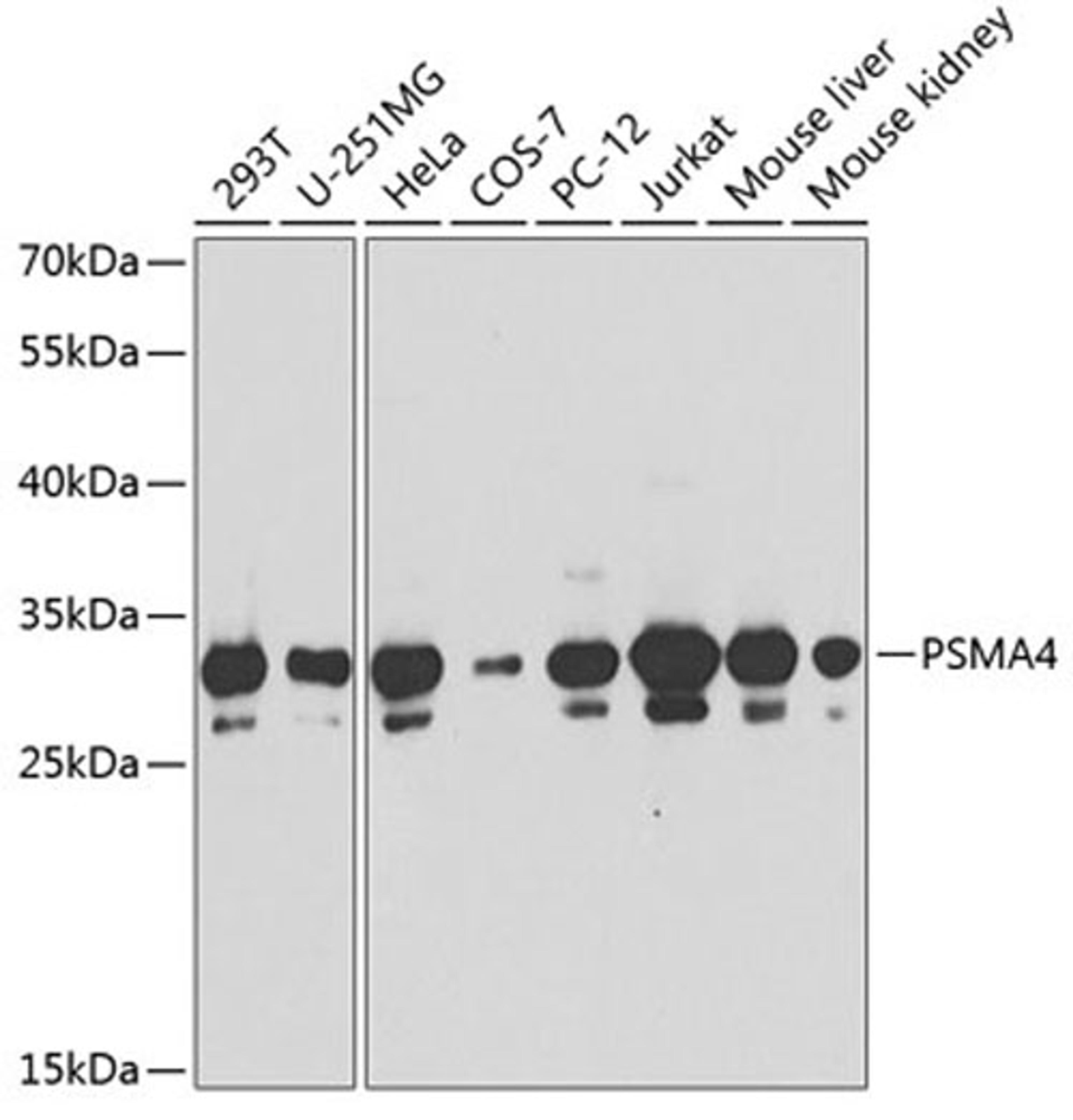 Western blot - PSMA4 antibody (A13535)