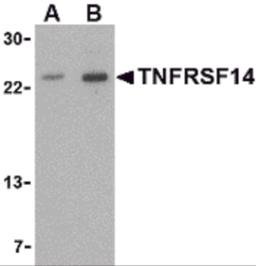 Western blot analysis of TNFRSF14 in mouse thymus tissue lysate with TNFRSF14 antibody at (A) 1 and (B) 2 &#956;g/mL.