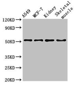 Western Blot. Positive WB detected in: A549 whole cell lysate, MCF-7 whole cell lysate, Mouse kidney tissue, Mouse skeletal muscle tissue. All lanes: NARF antibody at 3ug/ml. Secondary. Goat polyclonal to rabbit IgG at 1/50000 dilution. Predicted band size: 52, 57, 46, 45 kDa. Observed band size: 52 kDa. 