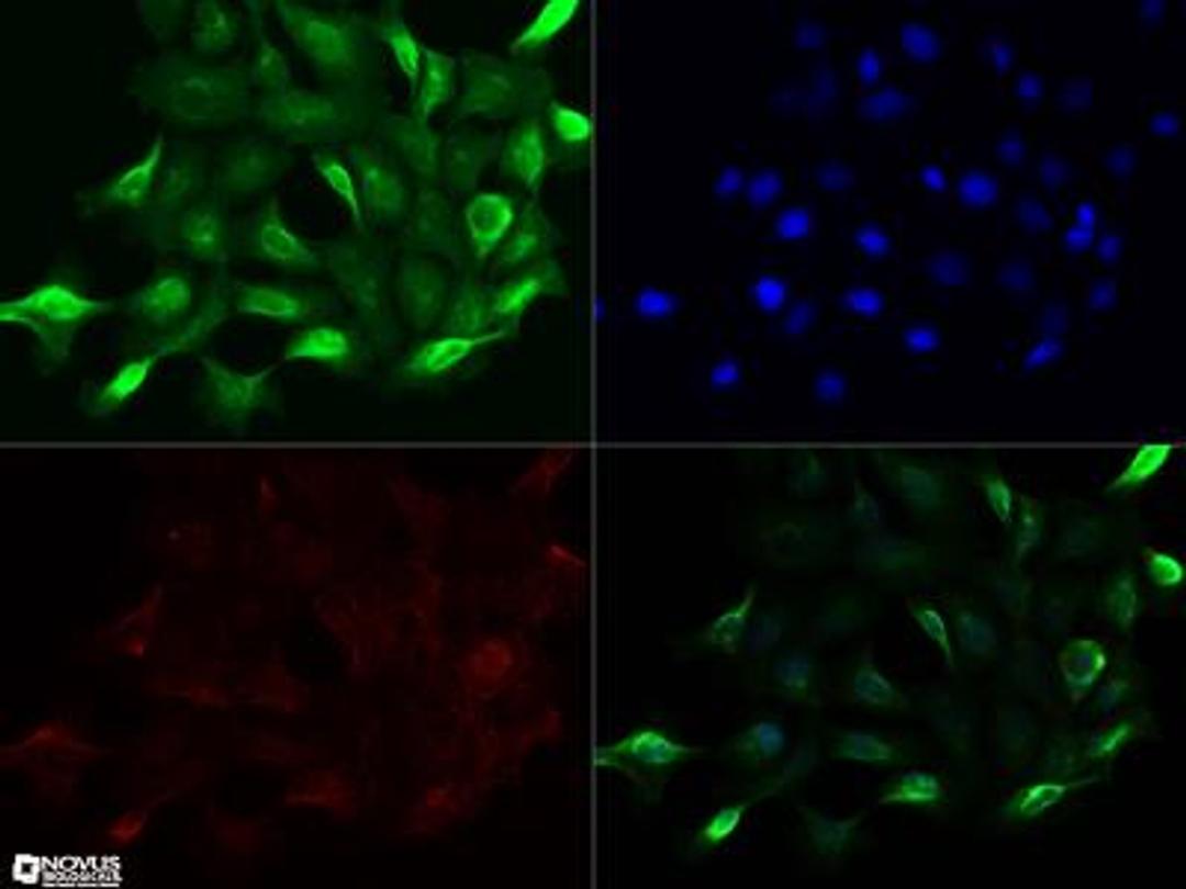 Immunocytochemistry/Immunofluorescence: NUT Antibody (46B3D2.1G6) [NBP2-31146] - NUT antibody was tested in A431 cells with Dylight 488 (green). Nuclei and alpha-tubulin were counterstained with DAPI (blue) and Dylight 550 (red). An antibody concentration of 0.1 ug/ml was used. Image objective 40x.