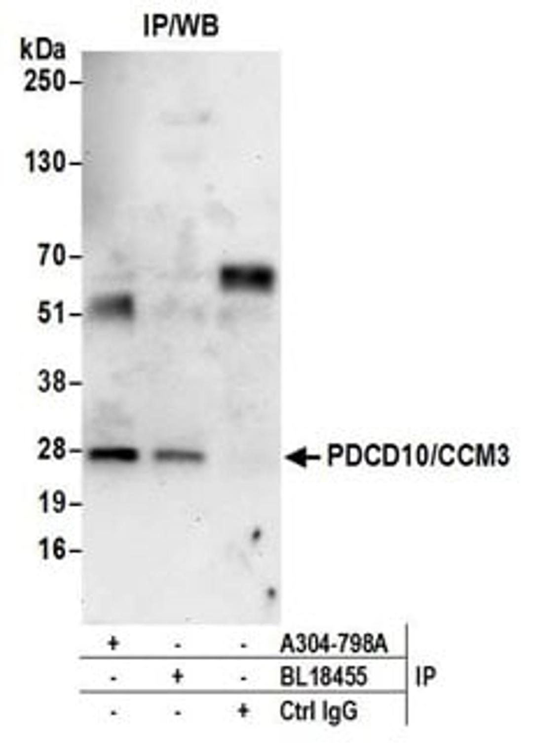 Detection of human PDCD10/CCM3 by western blot of immunoprecipitates.