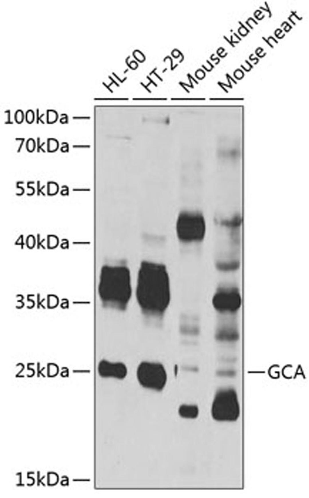 Western blot - GCA antibody (A7086)