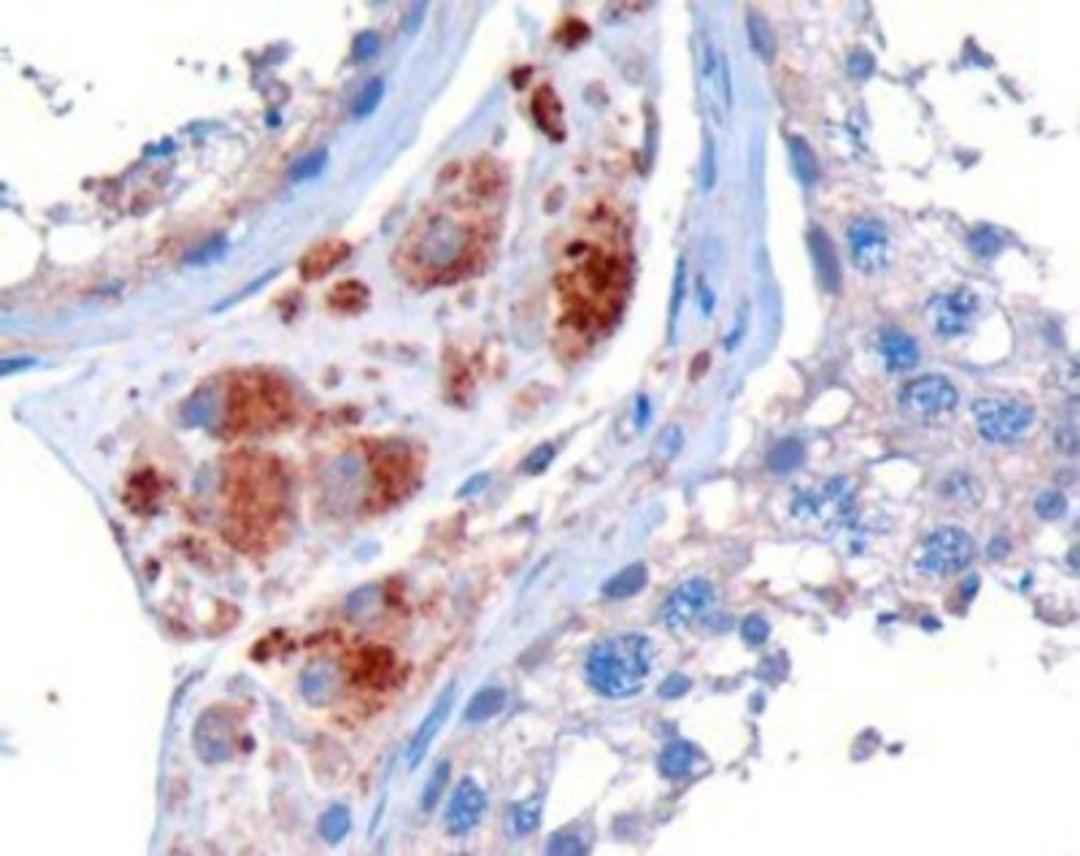 Immunohistochemistry-Paraffin: STK35 Antibody [NB100-1393] - (10ug/ml) Staining of Human Testis. Microwaved antigen retrieval with Tris/EDTA buffer pH9, HRP-staining.