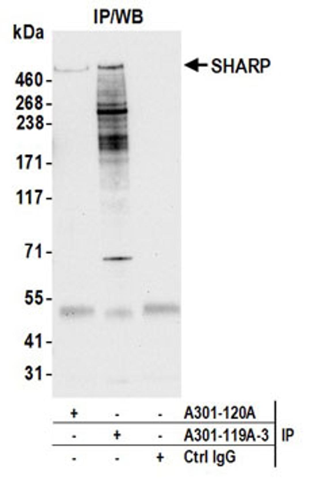 Detection of human SHARP by western blot of immunoprecipitates.