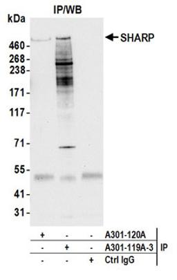 Detection of human SHARP by western blot of immunoprecipitates.