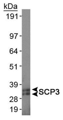 Western Blot: SCP3 Antibody [NB300-232] - Analysis of SCP3 in mouse testis protein.