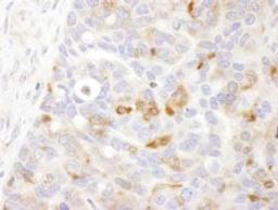 Detection of human Bin1 by immunohistochemistry.