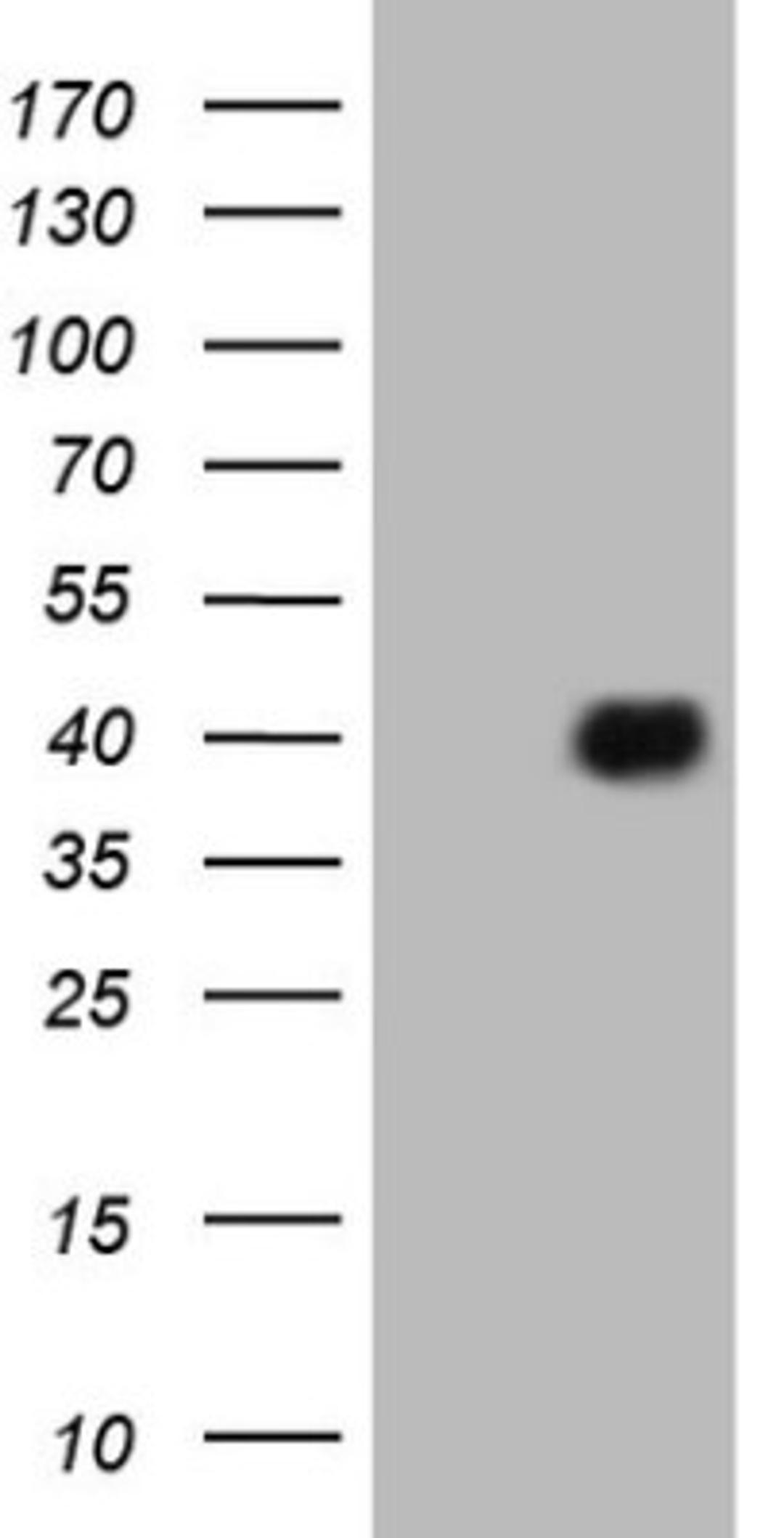 Western Blot: ATF1 Antibody (2B4) [NBP2-46552] - Analysis of HEK293T cells were transfected with the pCMV6-ENTRY control (Left lane) or pCMV6-ENTRY ATF1.