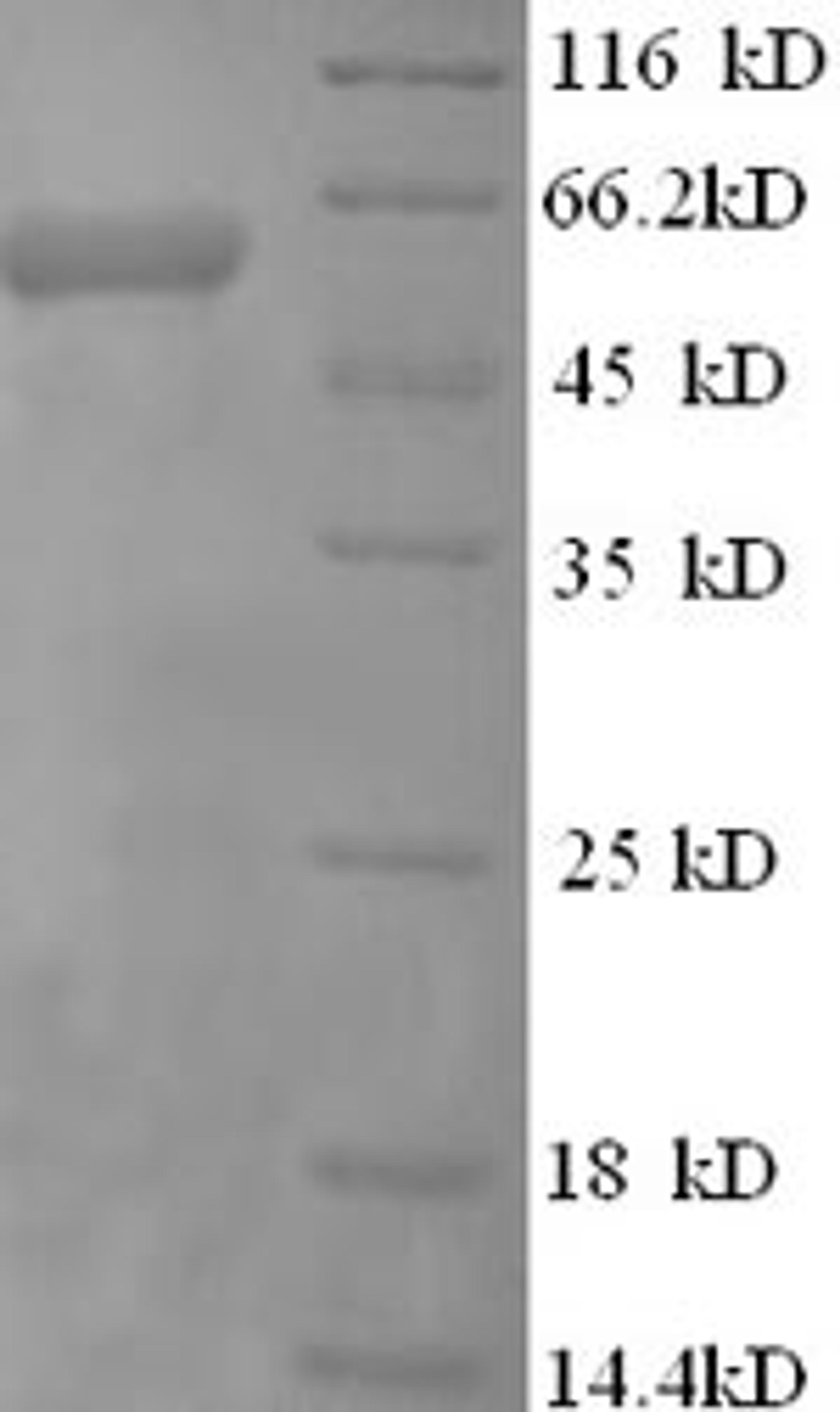 (Tris-Glycine gel) Discontinuous SDS-PAGE (reduced) with 5% enrichment gel and 15% separation gel.