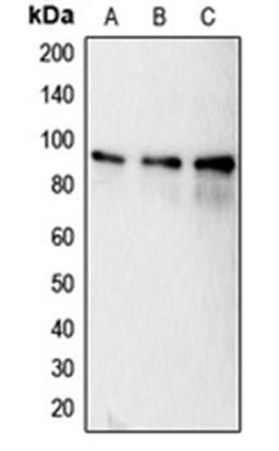 Western blot analysis of MCF7 (Lane 1), HeLa (Lane 2), MDAMB231 (Lane 3) whole cell lysates using CANX antibody