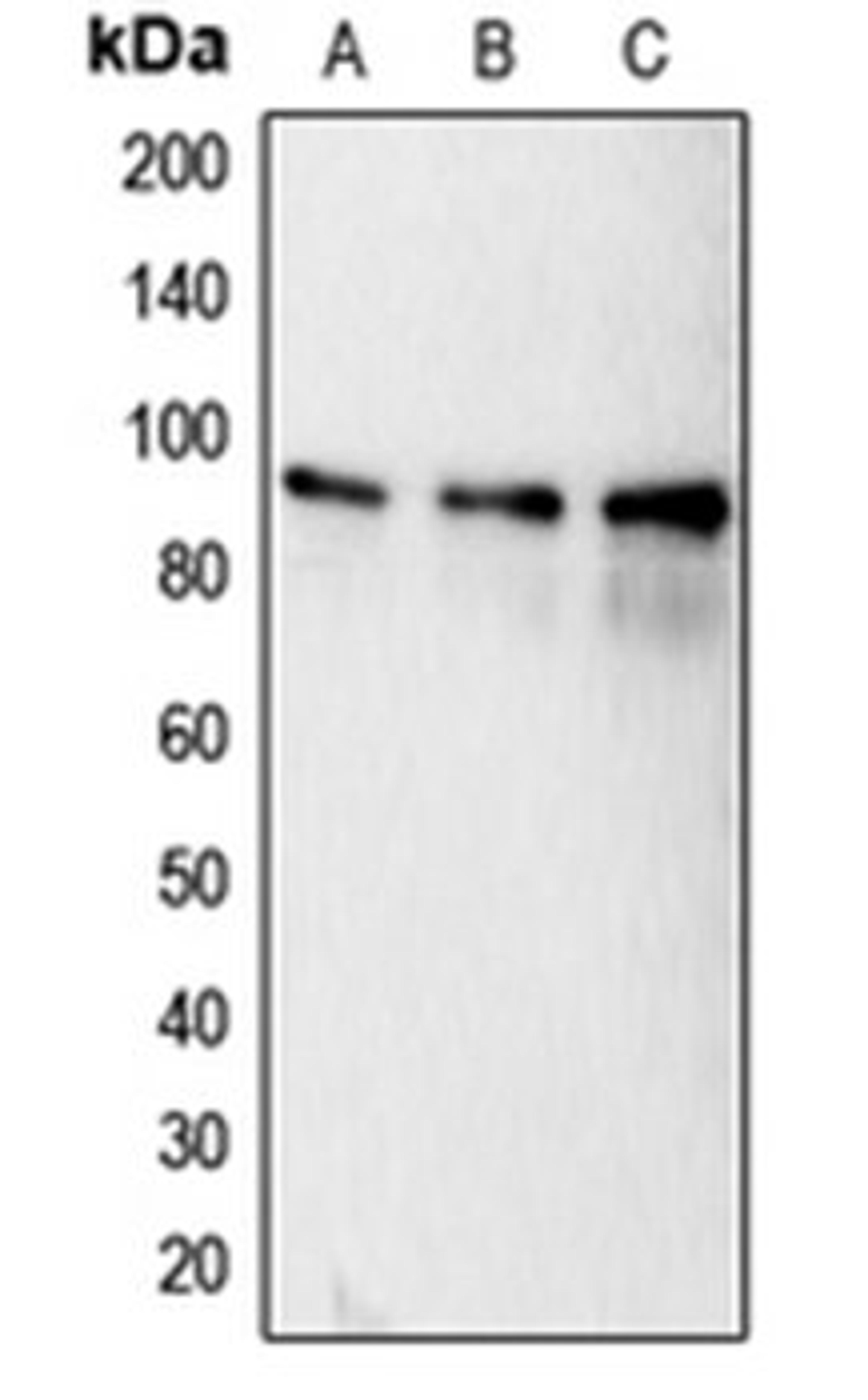 Western blot analysis of MCF7 (Lane 1), HeLa (Lane 2), MDAMB231 (Lane 3) whole cell lysates using CANX antibody