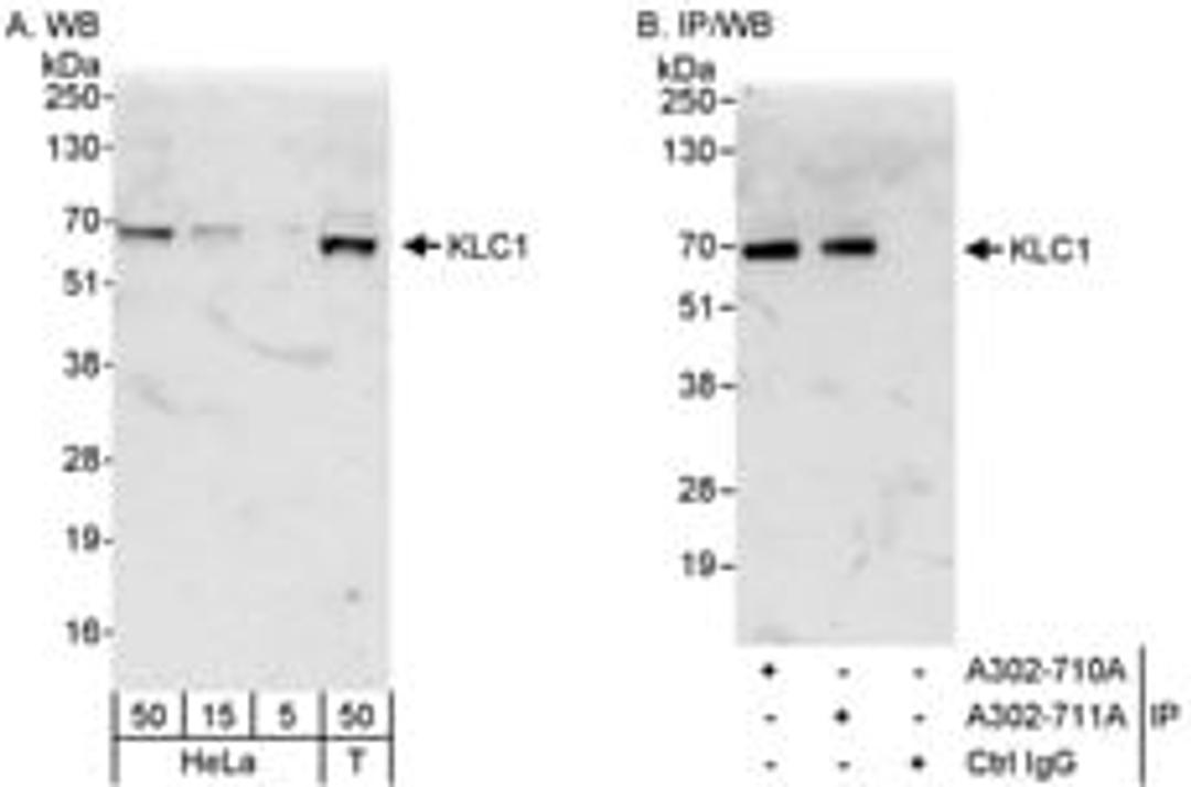 Detection of human KLC1 by western blot and immunoprecipitation.