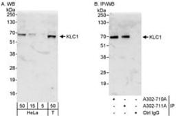 Detection of human KLC1 by western blot and immunoprecipitation.