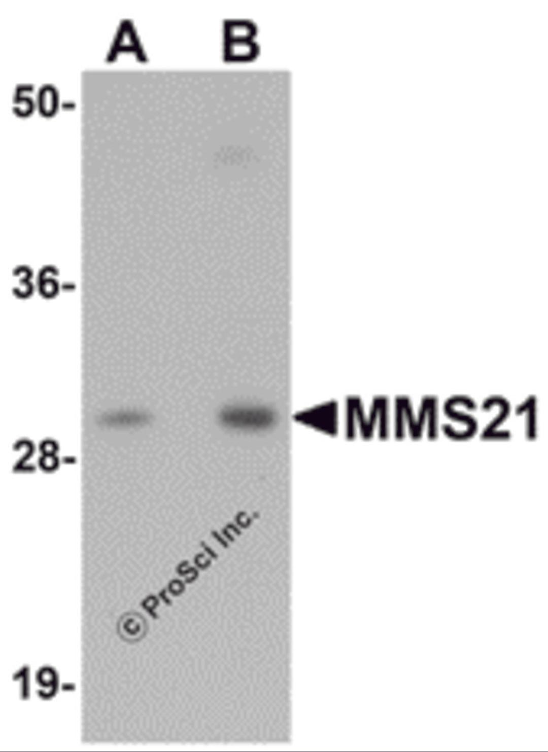 Western blot analysis of MMS21 in 293 cell lysate with MMS21 antibody at (A) 0.5 and (B) 1 μg/mL.