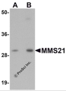 Western blot analysis of MMS21 in 293 cell lysate with MMS21 antibody at (A) 0.5 and (B) 1 μg/mL.
