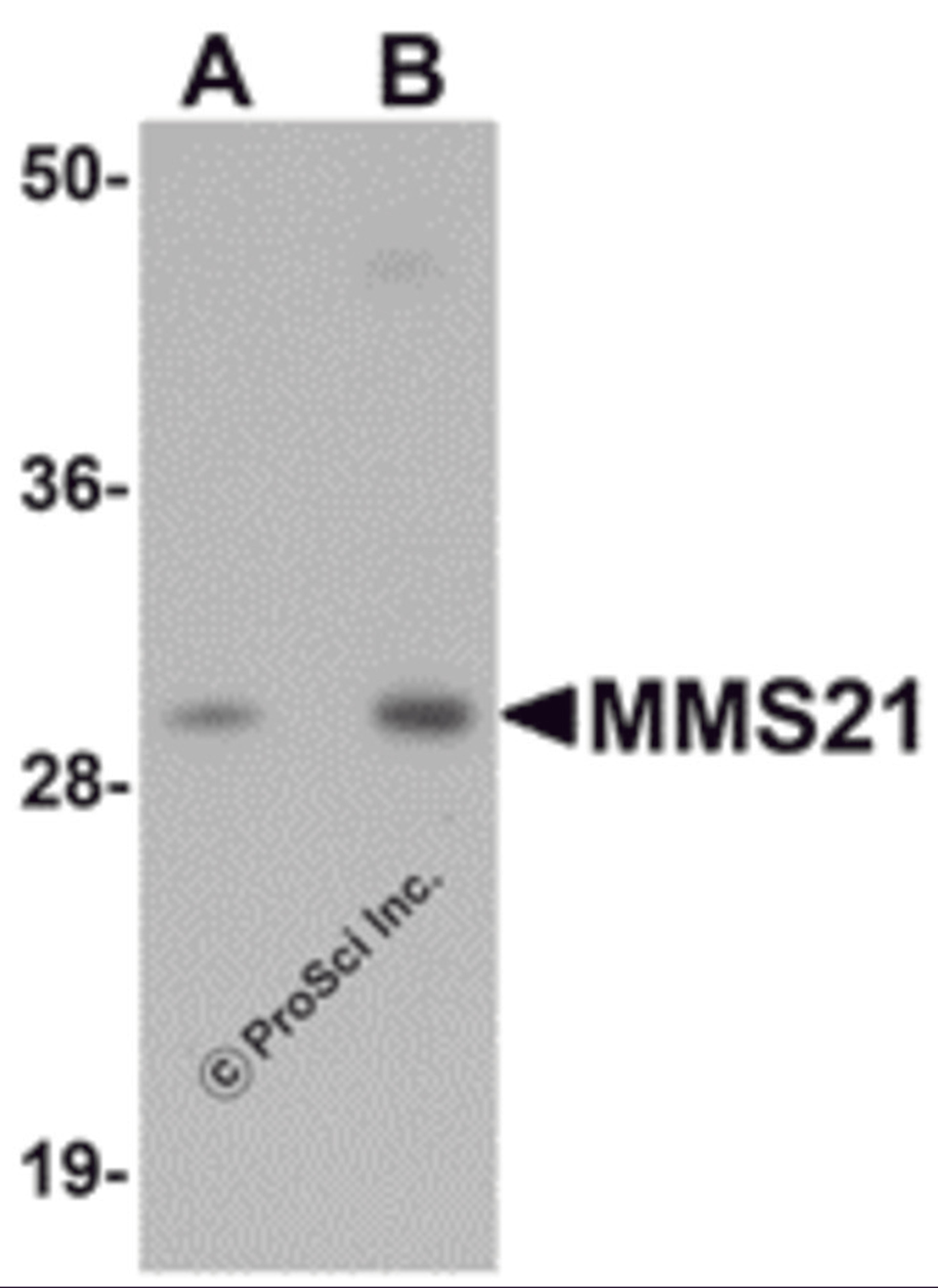 Western blot analysis of MMS21 in 293 cell lysate with MMS21 antibody at (A) 0.5 and (B) 1 μg/mL.