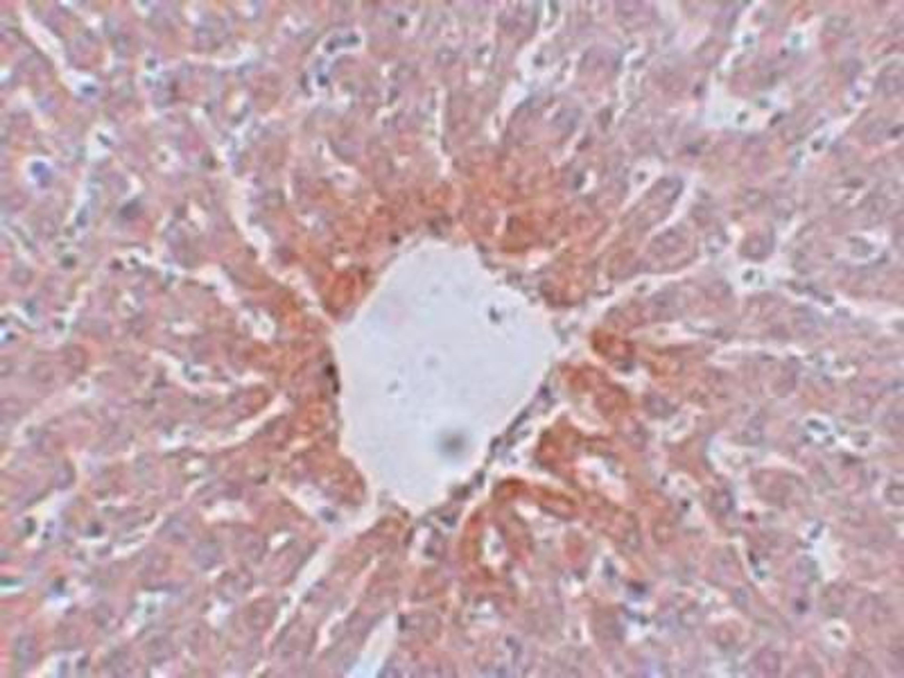 Immunohistochemistry-Paraffin: AGTR-2 Antibody [NBP1-77368] - Rat liver tissue with AGTR2 antibody at 5 ug/ml.