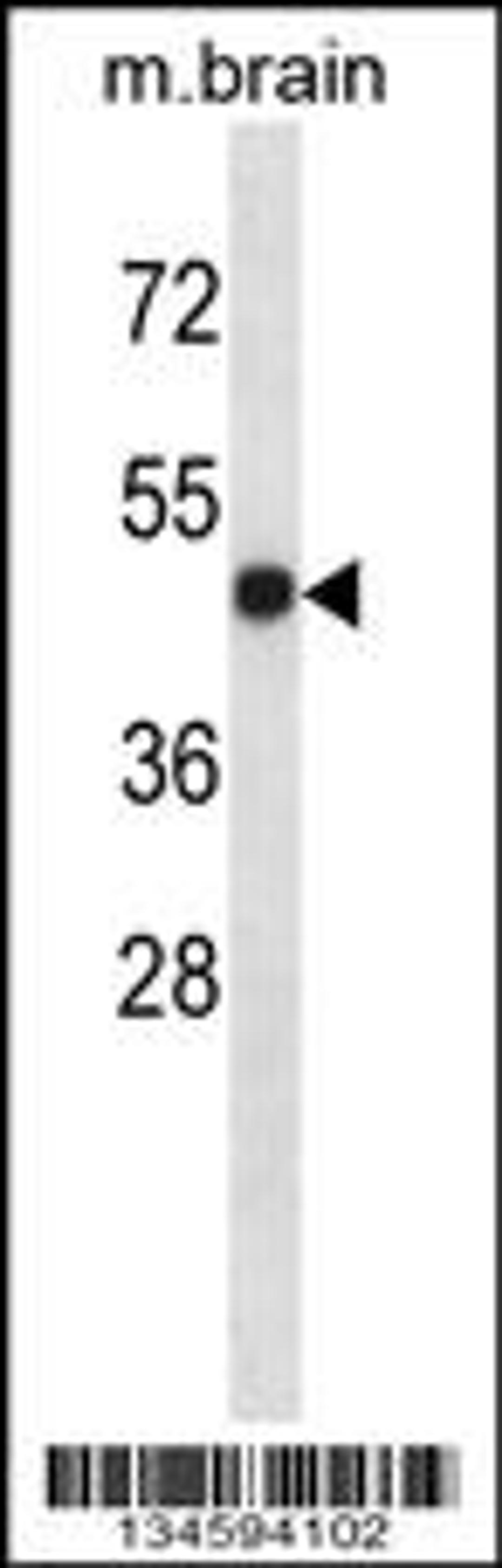 Western blot analysis in mouse brain tissue lysates (35ug/lane).