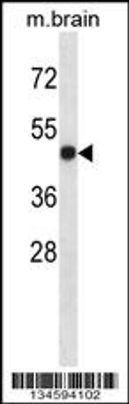 Western blot analysis in mouse brain tissue lysates (35ug/lane).