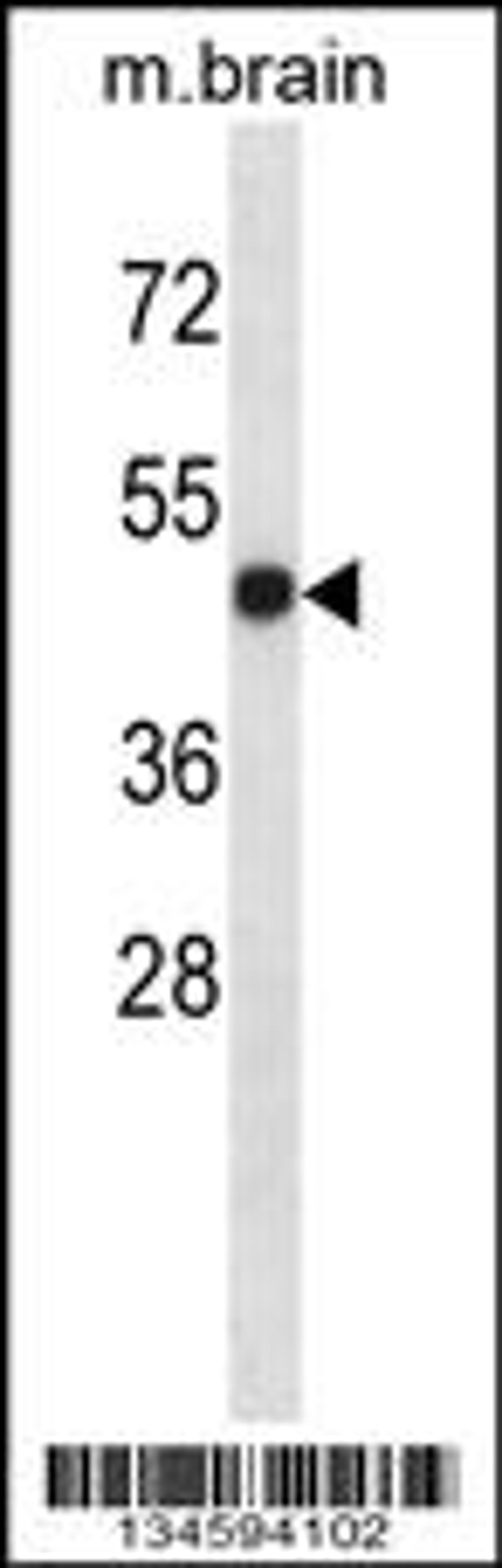 Western blot analysis in mouse brain tissue lysates (35ug/lane).