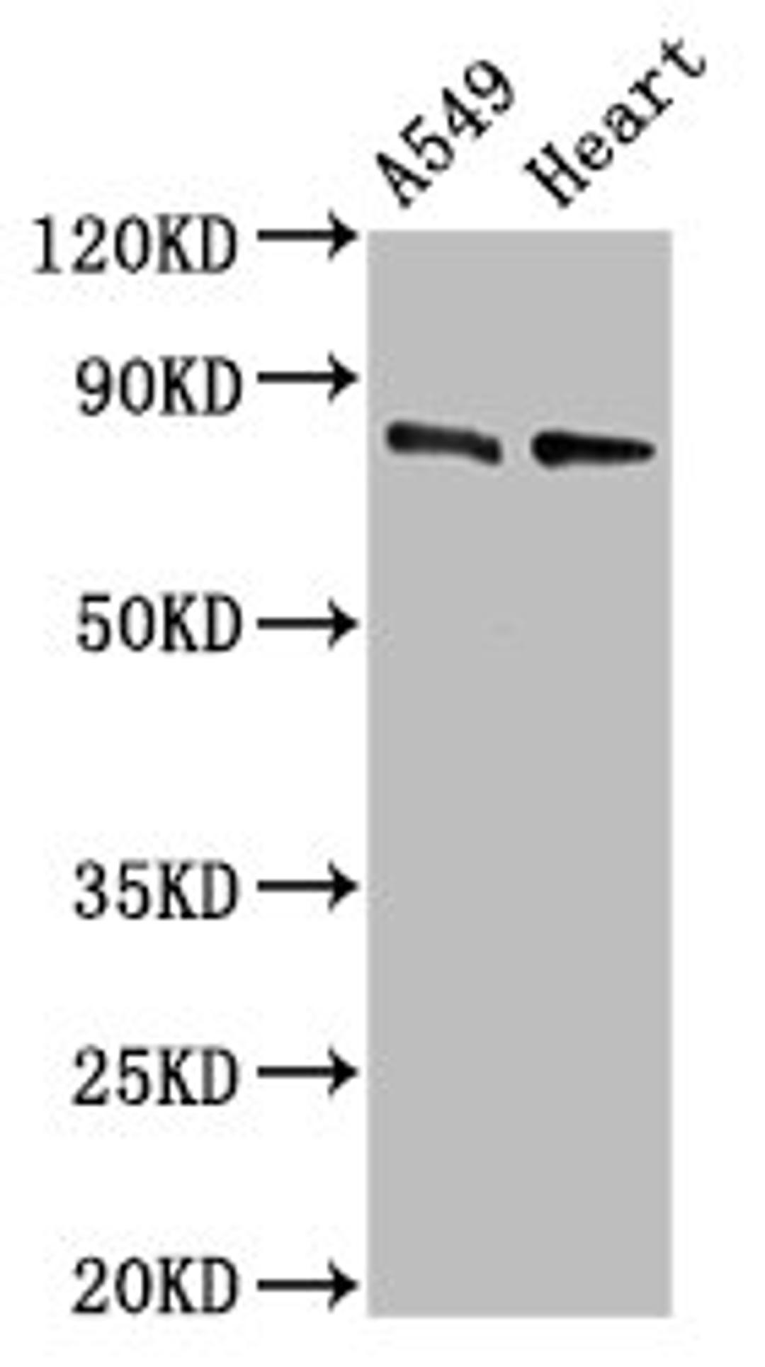Western Blot. Positive WB detected in: A549 whole cell lysate, Mouse heart tissue. All lanes: DNM1L antibody at 0.5µg/ml. Secondary. Goat polyclonal to rabbit IgG at 1/50000 dilution. Predicted band size: 82, 81, 80, 79, 84, 61, 83 kDa. Observed band size: 82 kDa