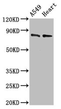Western Blot. Positive WB detected in: A549 whole cell lysate, Mouse heart tissue. All lanes: DNM1L antibody at 0.5µg/ml. Secondary. Goat polyclonal to rabbit IgG at 1/50000 dilution. Predicted band size: 82, 81, 80, 79, 84, 61, 83 kDa. Observed band size: 82 kDa