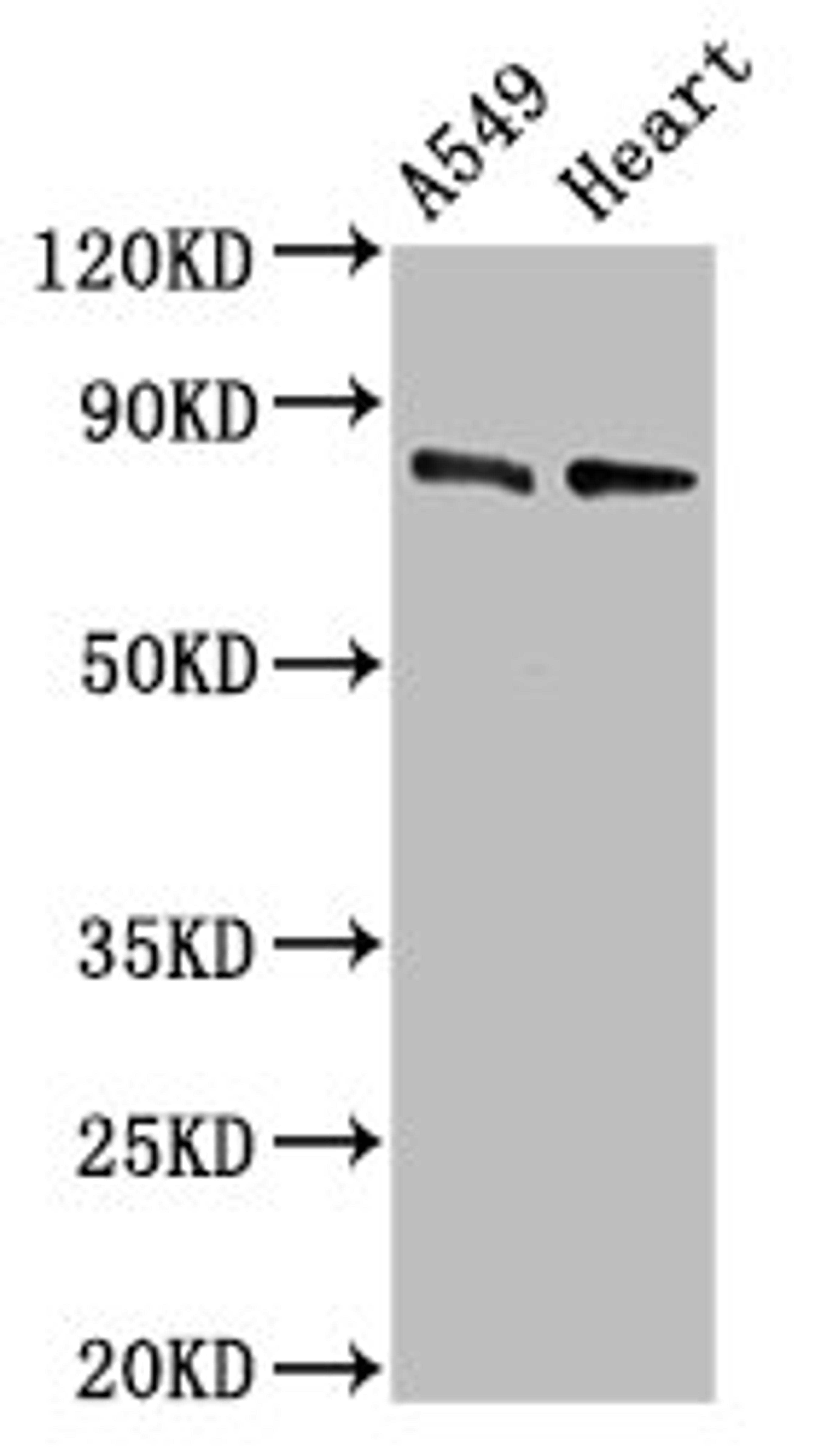 Western Blot. Positive WB detected in: A549 whole cell lysate, Mouse heart tissue. All lanes: DNM1L antibody at 0.5µg/ml. Secondary. Goat polyclonal to rabbit IgG at 1/50000 dilution. Predicted band size: 82, 81, 80, 79, 84, 61, 83 kDa. Observed band size: 82 kDa