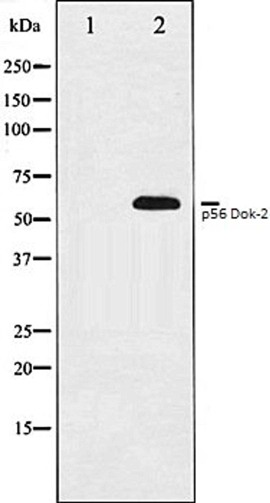 Western blot analysis of K562 whole cell lysates using p56 Dok-2 antibody, The lane on the left is treated with the antigen-specific peptide.