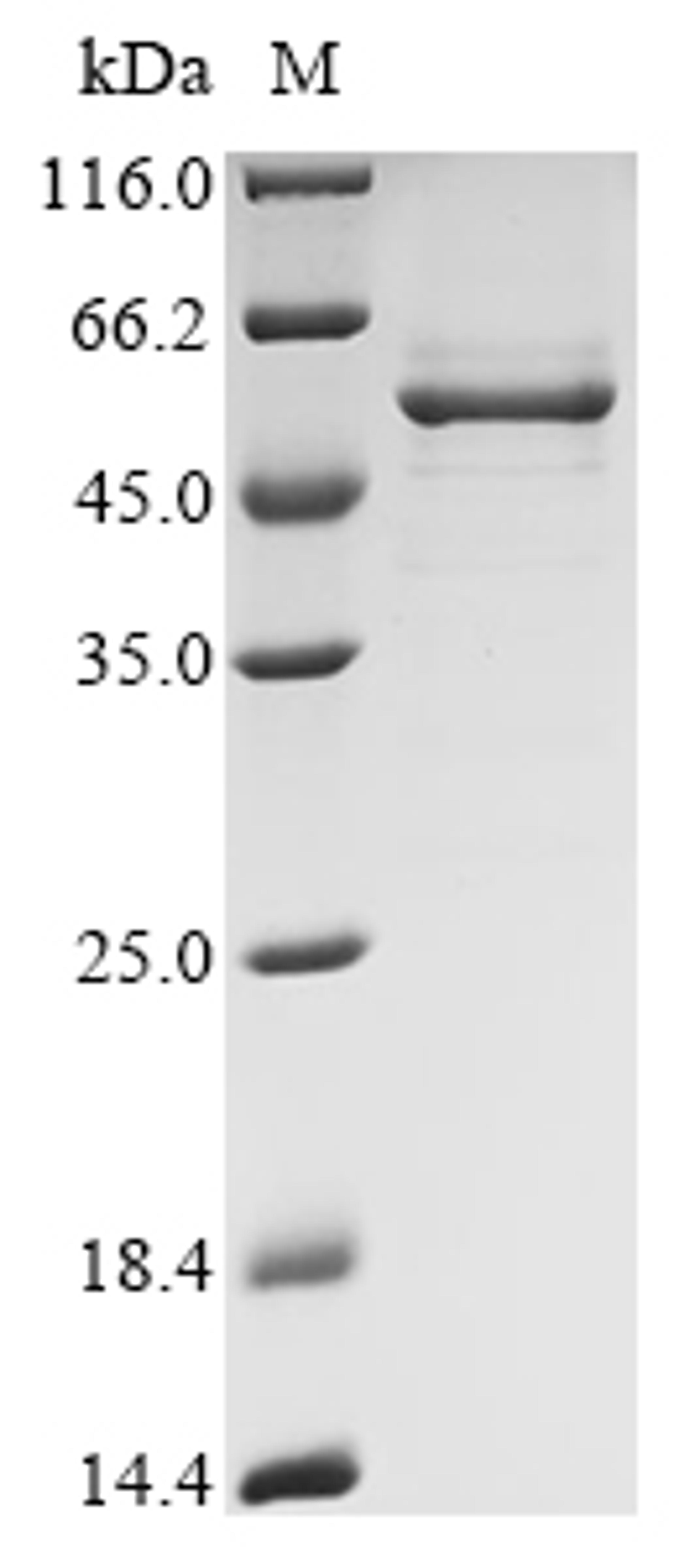 (Tris-Glycine gel) Discontinuous SDS-PAGE (reduced) with 5% enrichment gel and 15% separation gel.